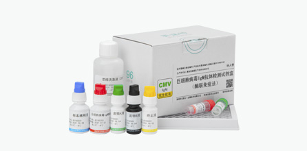 Cytomegalovirus IgM Antibody Test Kit (ELISA)