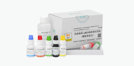 Rubella Virus IgM Antibody Test Kit (ELISA)