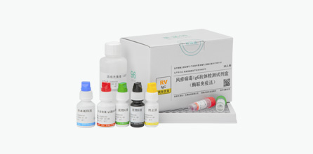 Rubella Virus IgG Antibody Test Kit (ELISA)