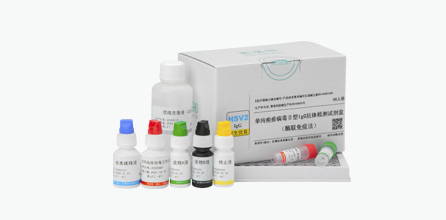 Herpes Simplex Virus Type II IgG Antibody Test Kit (ELISA)